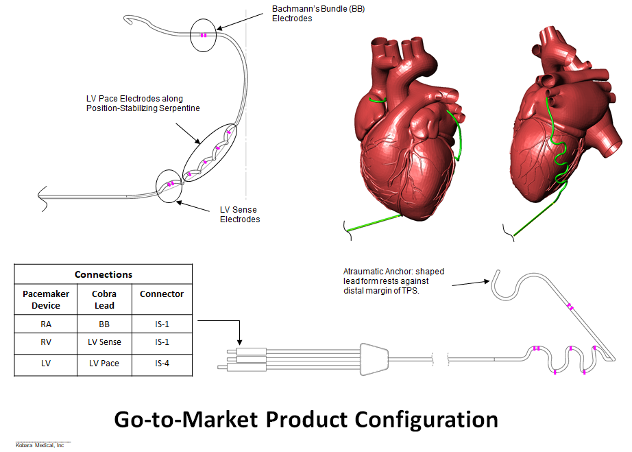 Surgical Epicardial Placement Of Lv Lead | Paul Smith